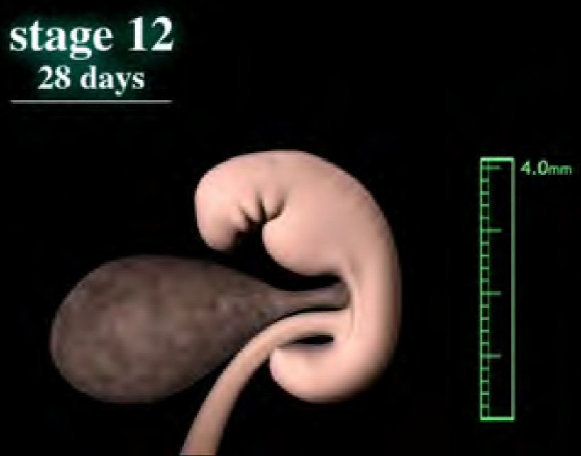 Human embryo, stage 12