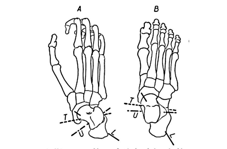Lateral view of ankle
