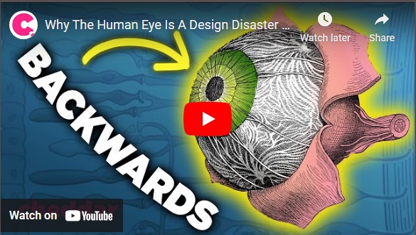 Why the human eye is a disaster